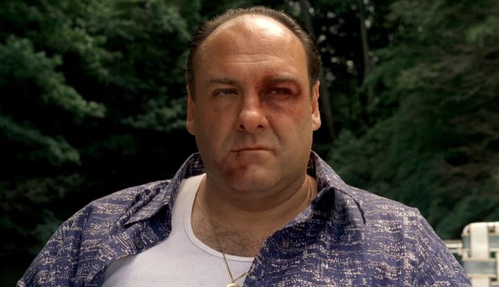Image of Tony Soprano with a black eye. 