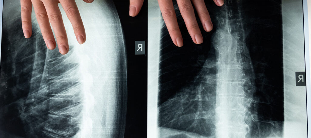 Picture of a backbone used to demonstrate one of the 7 core elements of fiction